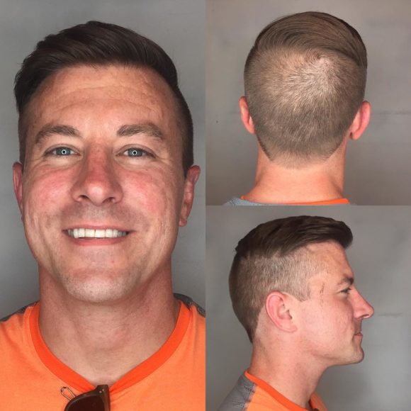 Classic High and Tight Undercut Combover on Brown Hair